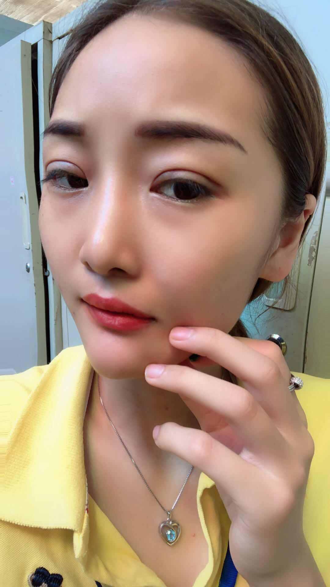 最新技術不開刀雙眼皮，重塑美麗無需手術刀的時代來臨，無創(chuàng)雙眼皮技術，重塑美麗，告別手術刀的時代來臨